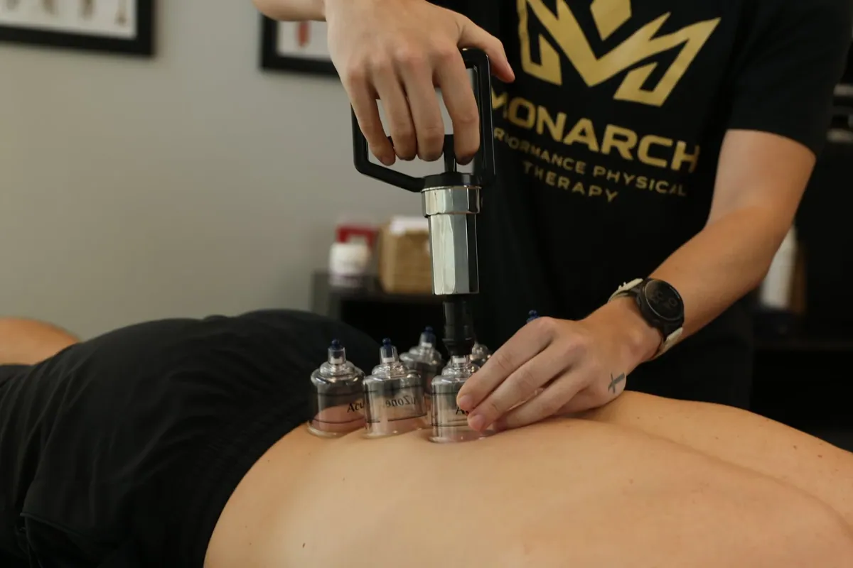 A clinician in a Monarch Performance Physical Therapy shirt places cupping cups on a patient's back